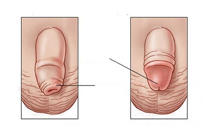 ¿Qué tarea realiza el lubricante